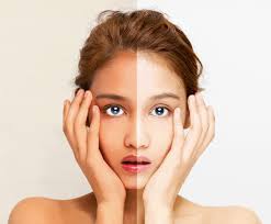Beyond Whitening- Synlotic Biotech ၏ သိပ္ပံနည်းကျ ချဉ်းကပ်နည်း